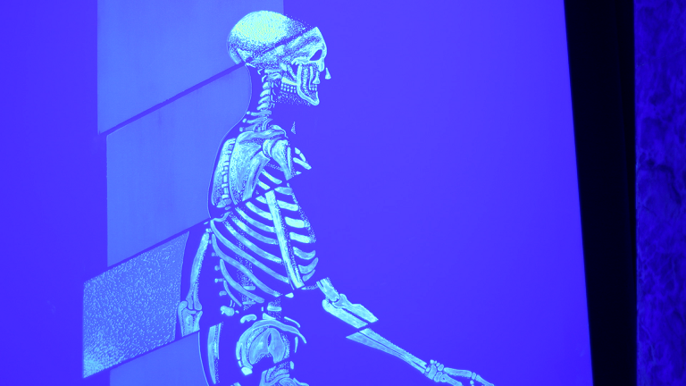 La visión de los pacientes con mieloma múltiple a través del arte