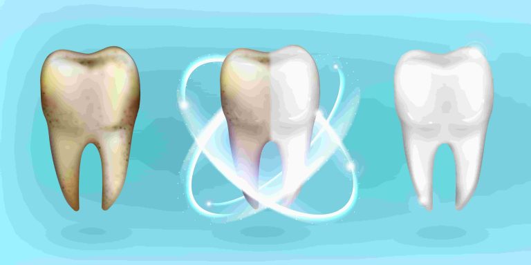 evitar dientes amarillos