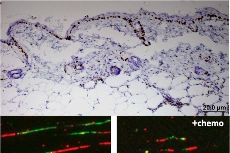 Descubren cómo el cáncer escapa de la quimioterapia