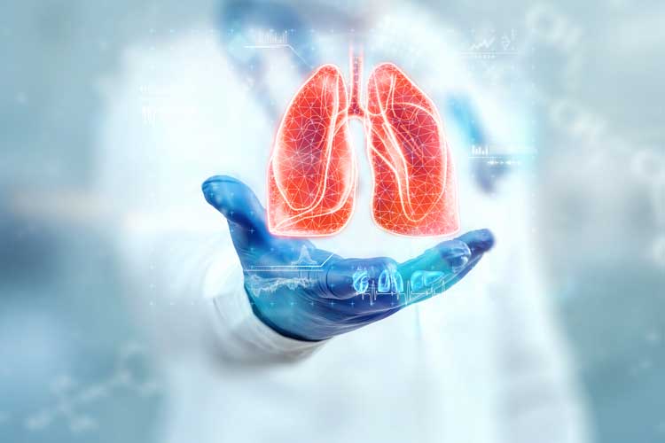 Amivantamab: novedades en el tratamiento del cáncer de pulmón