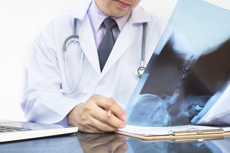 Colitis ulcerosa: recomendación favorable del CHMP para una nueva opción terapéutica