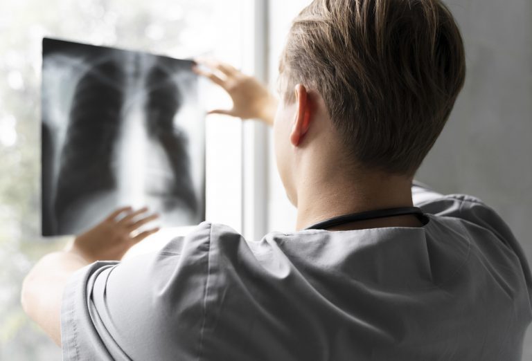 Más tiempo de vida y menos síntomas: así avanza el tratamiento del cáncer de pulmón
