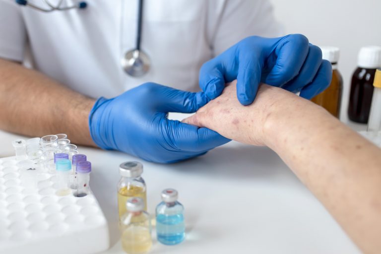 Un paso adelante en el tratamiento de la psoriasis en placas