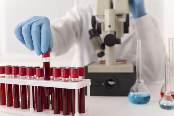 Muestras de sangre en laboratorio