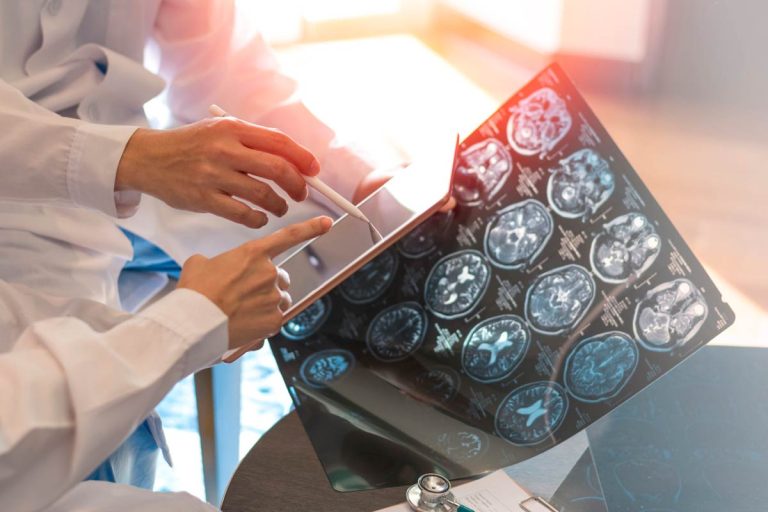 Glioma difuso, vorasidenib