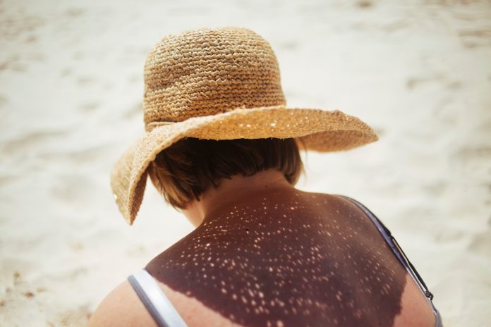 Protección solar en verano: qué dice la ciencia sobre cómo protegerse del sol — Foto de Meg Sanchez en Unsplash